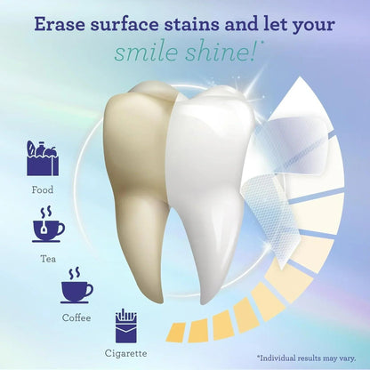 Whitening Strips (30-day treatment)